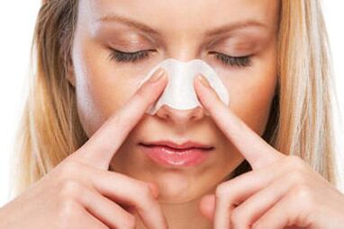 Rinoplastie du nez