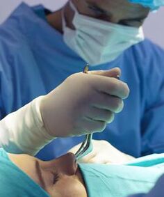 Réaliser une chirurgie plastique fermée du nez